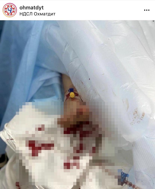 Savaşın korkunç yüzü! Rus bombalarıyla ağır yaralanan çocuğun fotoğrafları yürek parçaladı Savaşın korkunç yüzü! Rus bombalarıyla ağır yaralanan çocuğun fotoğrafları yürek parçaladı