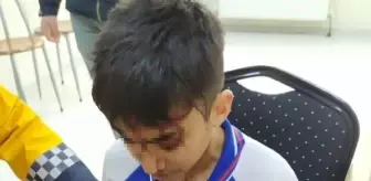 Efe, okul dönüşü köpek saldırısında başından yaralandı
