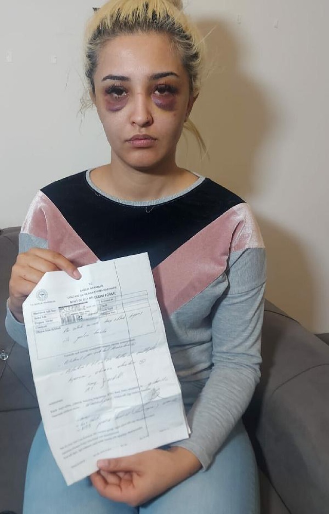 Eski kız arkadaşını darp ettikten sonra cinsel ilişkiye girmek istedi, ret alınca daha fazla dövdü Eski kız arkadaşını darp ettikten sonra cinsel ilişkiye girmek istedi, ret alınca daha fazla dövdü