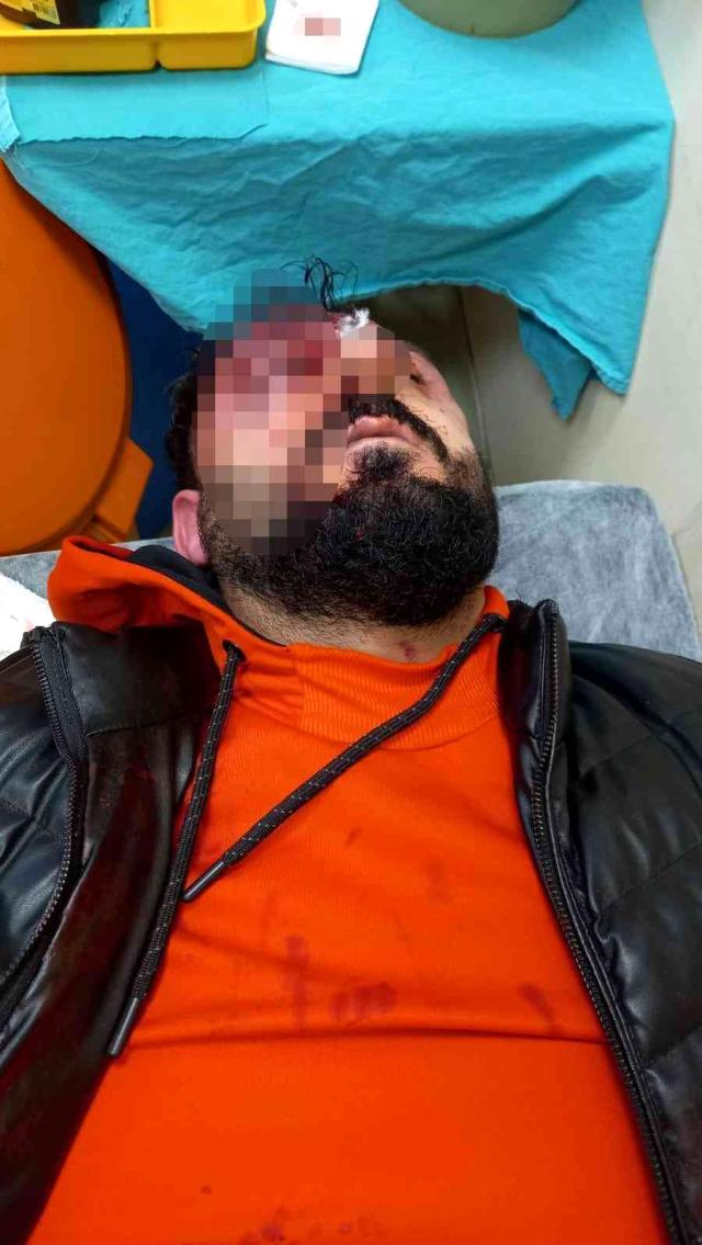 Son dakika haberleri: 'Kime geldiniz' dedi öldüresiye dayak yedi: Apartman içindeki dehşet anları kamerada
