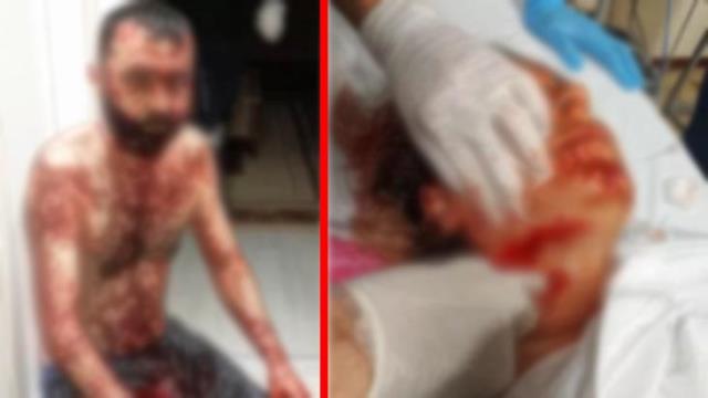 Maket bıçaklı saldırgan için eski eşi uzaklaştırma kararı aldırmış Maket bıçaklı saldırgan için eski eşi uzaklaştırma kararı aldırmış