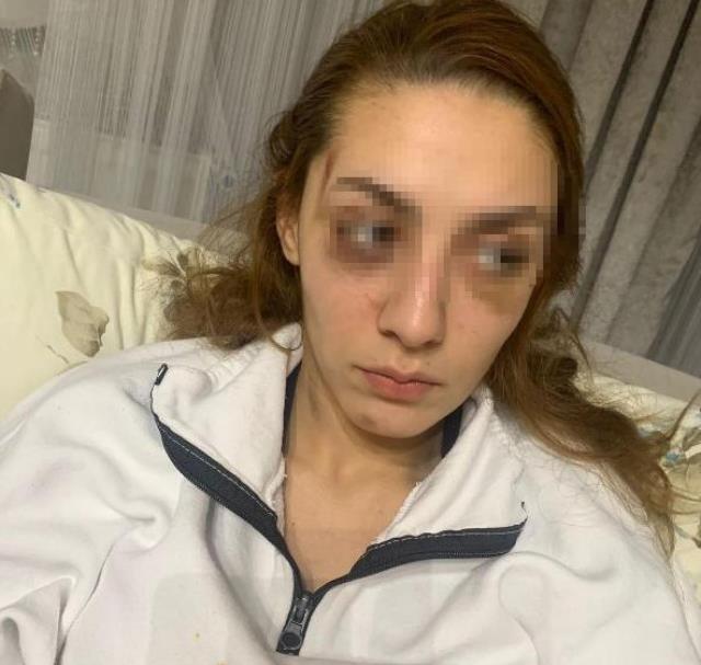 Eşofmanı yüzünden terk edildi, barışma teklifini kabul etmeyince öldüresiye dövüldü