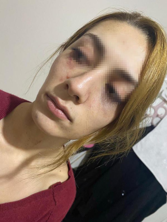 Eşofmanı yüzünden terk edildi, barışma teklifini kabul etmeyince öldüresiye dövüldü