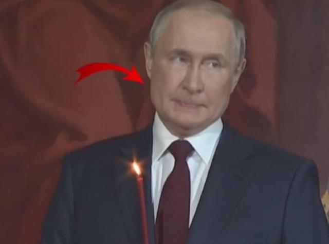Putin'le ilgili bomba iddia! Kanser tedavisi için bıçak altına yatıyor Putin'le ilgili bomba iddia! Kanser tedavisi için bıçak altına yatıyor