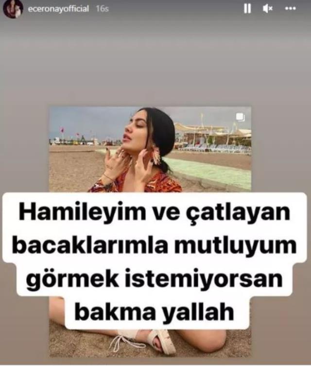 Ünlü fenomen Ece Ronay, çatlaklarıyla ilgili gelen yoruma sinirlenip takipçisine ateş püskürdü