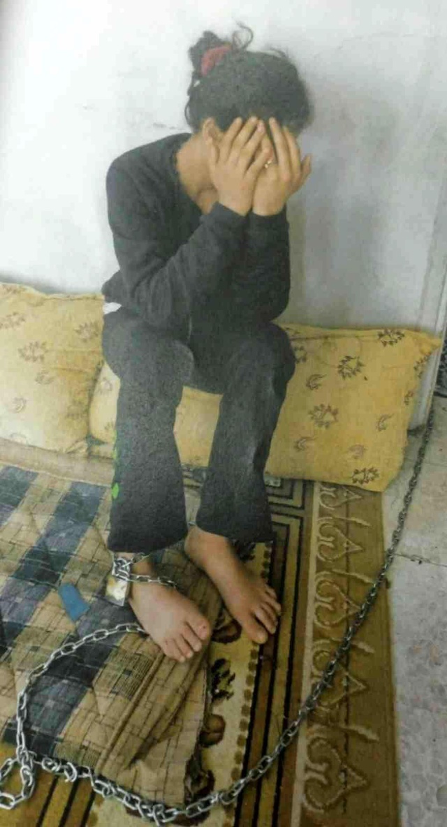 13 yaşındaki kızı kaçmasında diye 1 ay boyunca zincirle ayağından bağladılar 13 yaşındaki kızı kaçmasında diye 1 ay boyunca zincirle ayağından bağladılar