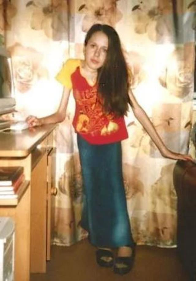 30 yıldan bu yana kalçasının üzerine oturamıyor! Hayattaki tek isteği herkesi hüzünlendirdi 30 yıldan bu yana kalçasının üzerine oturamıyor! Hayattaki tek isteği herkesi hüzünlendirdi