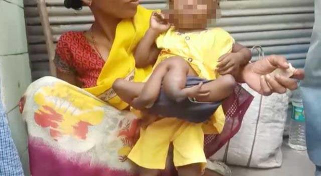 Hastanede tutulan örümcek bebek, görenleri hayrete düşürdü! İki eli ve toplamda 6 bacağı var