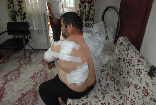 Ayı saldırısına uğrayan vatandaş ölü taklidi yaparak hayatta kaldı