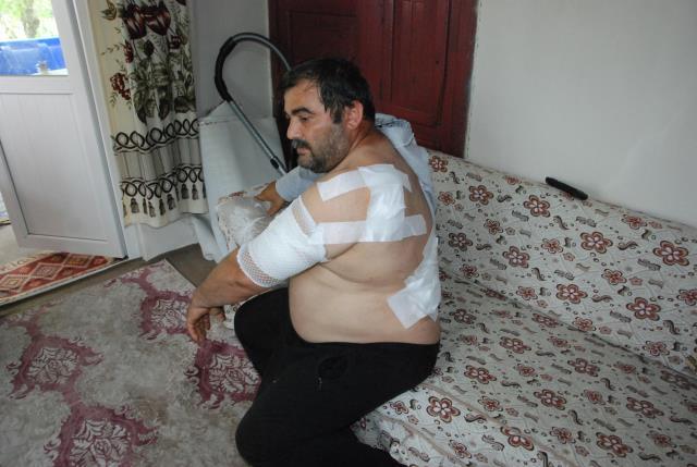 Ayı saldırısına uğrayan vatandaş ölü taklidi yaparak hayatta kaldı