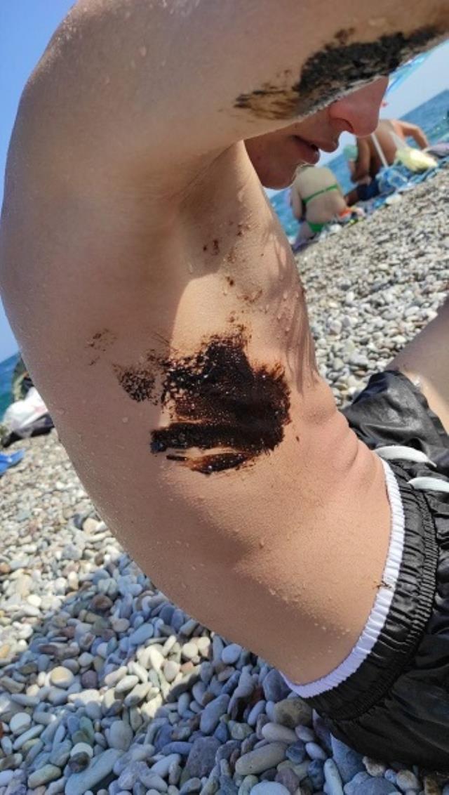 Antalya sahilleri zifte teslim! Denize giren vücudunda siyah lekelerle çıkıyor