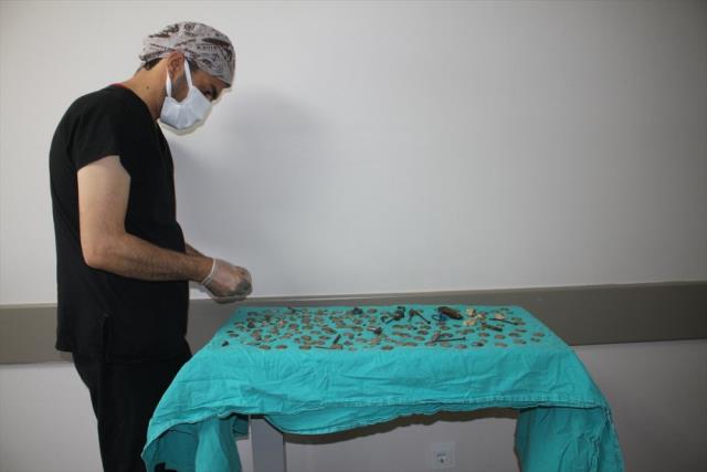 Karın ağrısı şikayetiyle hastaneye giden gencin midesinden çıkanlara doktorlar bile inanamadı Karın ağrısı şikayetiyle hastaneye giden gencin midesinden çıkanlara doktorlar bile inanamadı