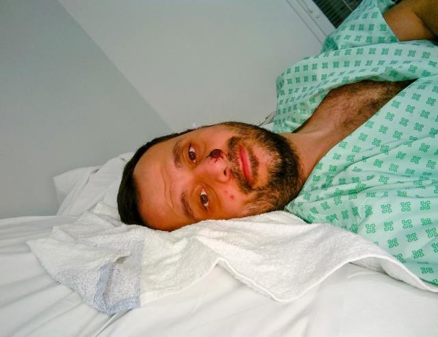 Maymun çiçeğine yakalanan Türk vatandaşı konuştu: Öleceğimi sandım