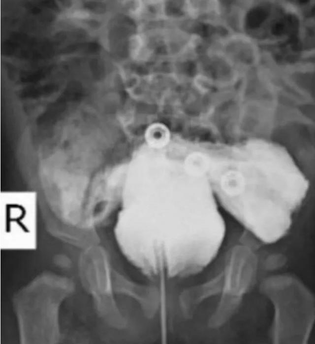 Ultrasonda hamile kadının karnındaki bebeğin cinsel bölgesine bakan doktorların ağzı açık kaldı