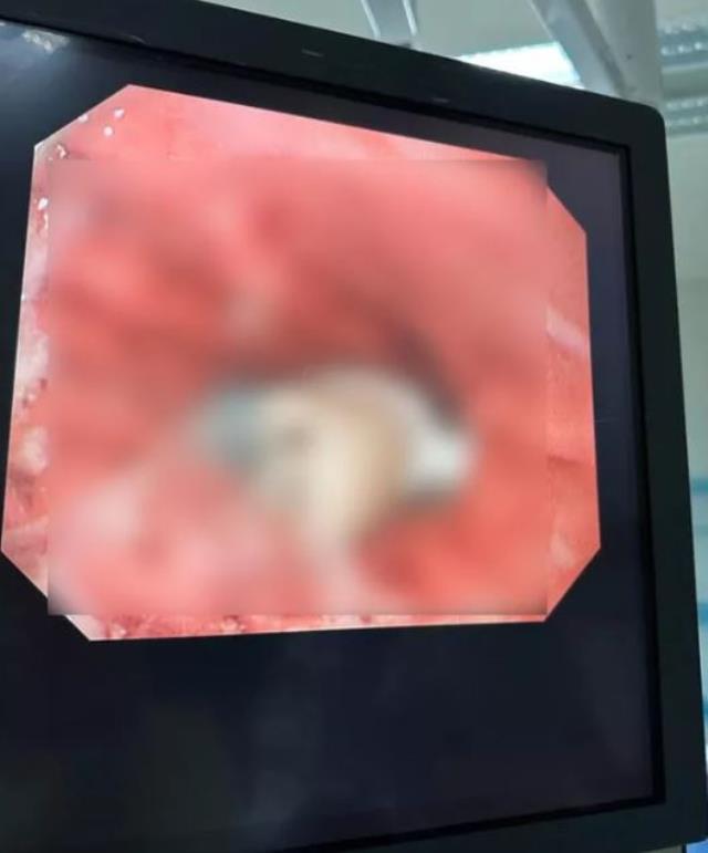 Korkunç ağrılarla hastaneye giden çocuğun röntgenine bakan doktorlar, anne babasına kızdı