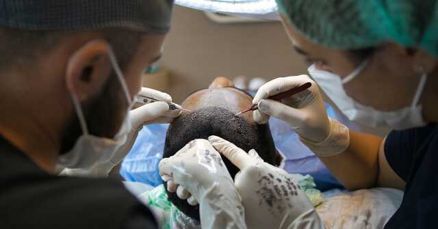 What is a FUE Hair Transplant? Is FUE Hair Transplant Permanent? Hair Transplant Before and After İstanbul, Türkiye What is a FUE Hair Transplant? Is FUE Hair Transplant Permanent? Hair Transplant Before and After İstanbul, Türkiye