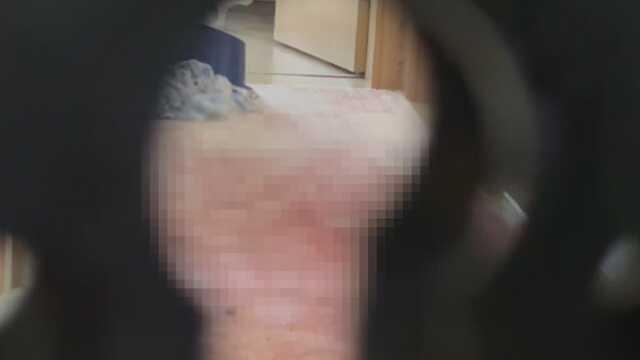 Cinnet evi kapı deliğinden görüntülendi! Mavi leğen ve kanlar içindeki halı dikkatlerden kaçmadı