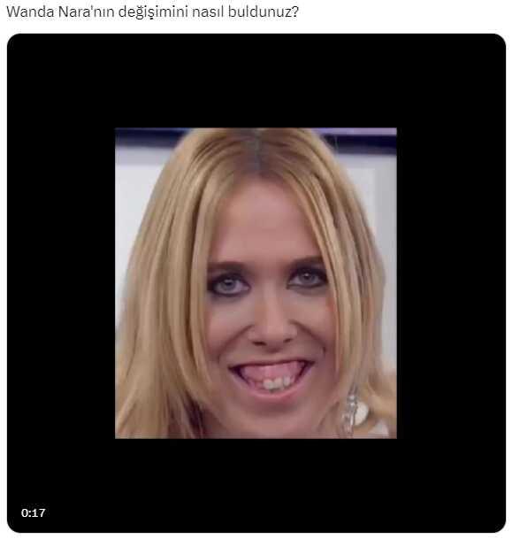 Fotoğrafın Wanda Nara'nın estetiksiz halini gösterdiği iddiası