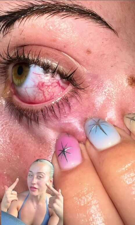 Avustralyalı Fenomenin 'Ateşli Kız Yürüyüşü' Sırasında Kuş Saldırısına Uğraması