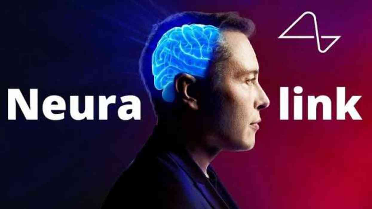 Elon Musk, beyin çipiyle bilgisayar faresinin kontrol edilebildiğini açıkladı Elon Musk, beyin çipiyle bilgisayar faresinin kontrol edilebildiğini açıkladı