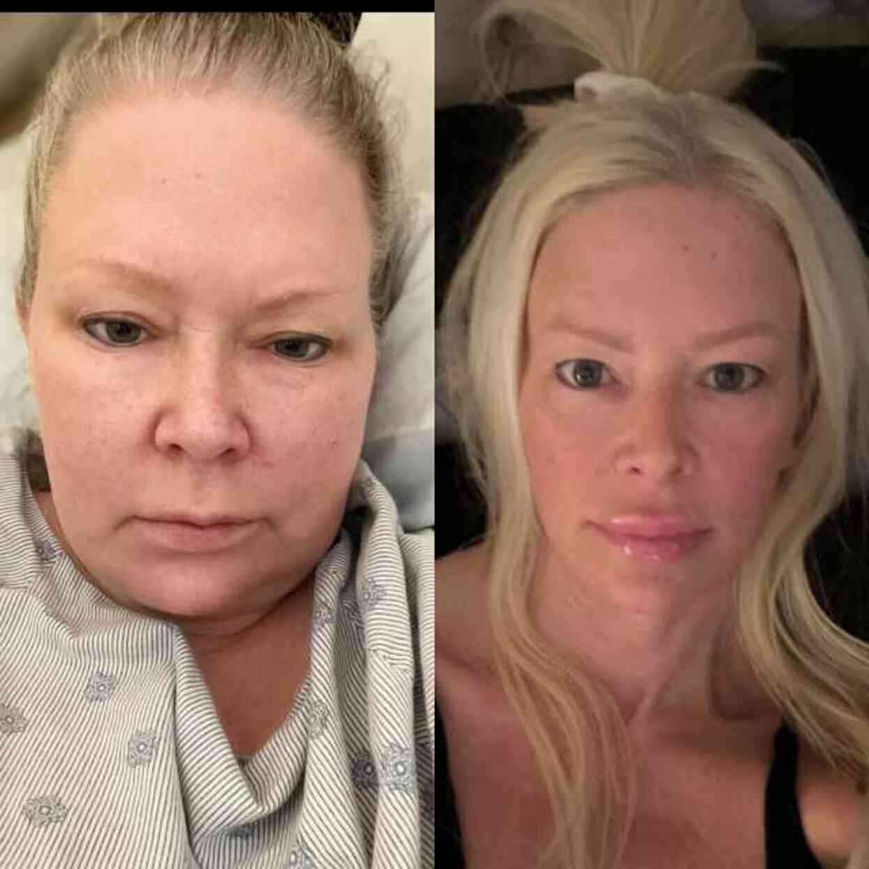 Nadir görülen rahatsızlıkla mücadele eden yetişkin film yıldızı Jenna Jameson, aldığı kilolarla dikkat çekti Nadir görülen rahatsızlıkla mücadele eden yetişkin film yıldızı Jenna Jameson, aldığı kilolarla dikkat çekti