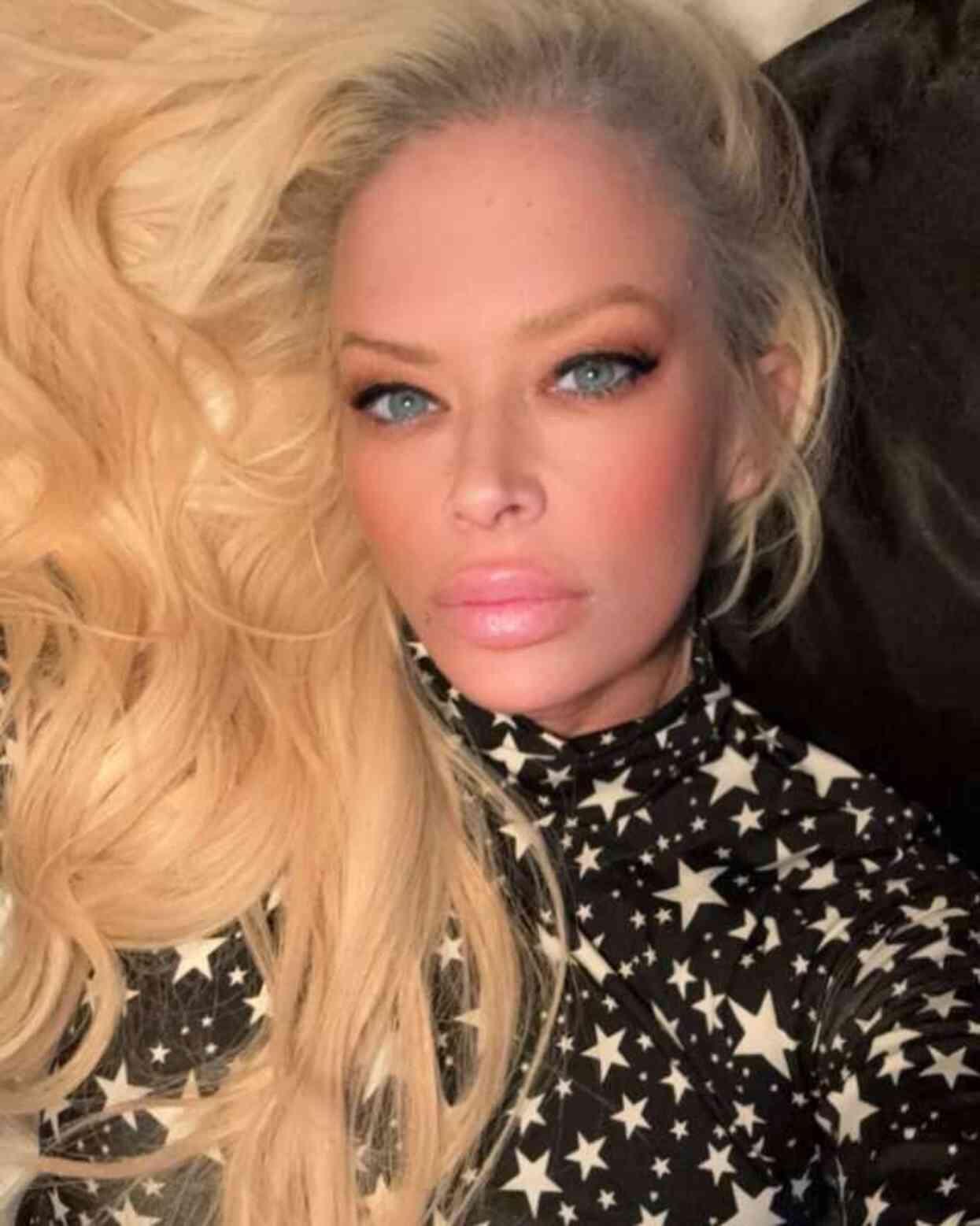 Yetişkin Film Yıldızı Jenna Jameson Nadir Görülen Rahatsızlıkla Mücadele Ediyor Son Dakika 6949