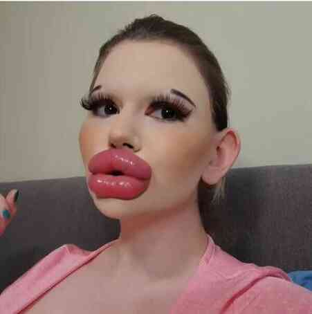 Dünyanın en büyük dudaklı kadını: Yeni bir rekor istiyorum, sırada en uzun çene var Dünyanın en büyük dudaklı kadını: Yeni bir rekor istiyorum, sırada en uzun çene var