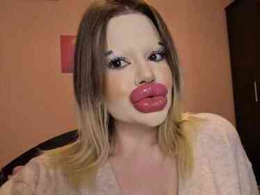 Dünyanın en büyük dudaklı kadını: Yeni bir rekor istiyorum, sırada en uzun çene var Dünyanın en büyük dudaklı kadını: Yeni bir rekor istiyorum, sırada en uzun çene var