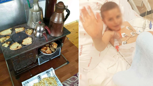 Sıcak patates 6 yaşındaki Muhammet'i öldürüyordu! 6 gün komada kaldı, nefes borusuna delik açıldı