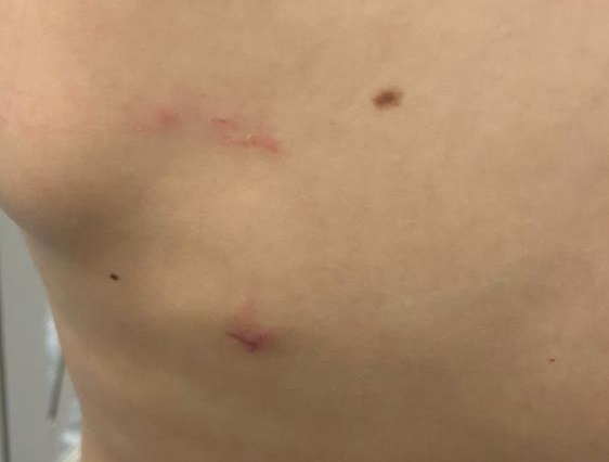 Okul müdürün beslediği 2 kangal köpeği 11 yaşındaki öğrenciye saldırdı