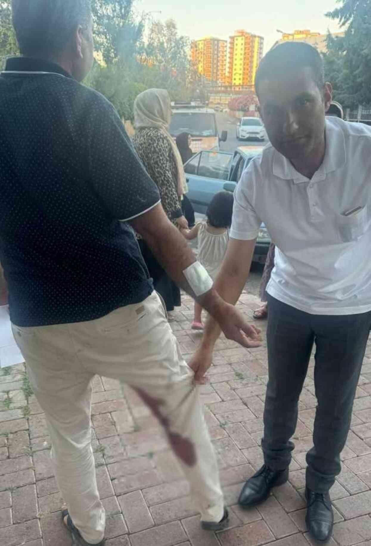Şanlıurfa'da kuduz köpeğin ısırdığı adam karantinaya alındı