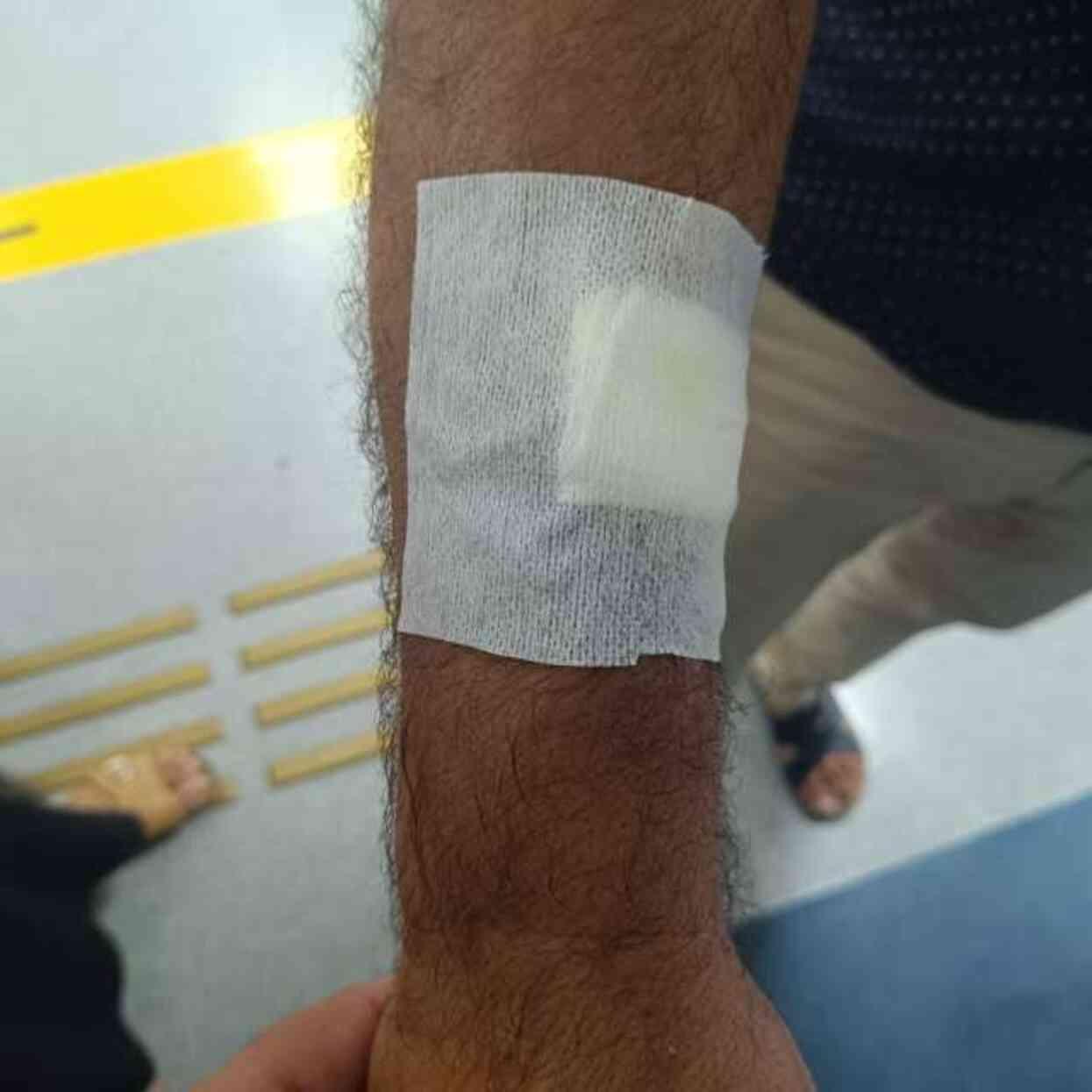 Şanlıurfa'da kuduz köpeğin ısırdığı adam karantinaya alındı