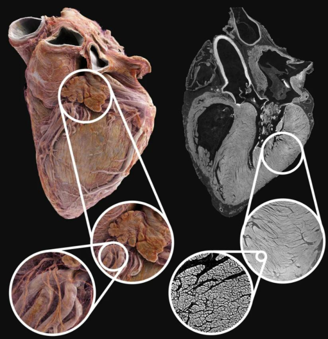 Bilim insanları, insan kalbinin iç yapısını ayrıntılı olarak gösteren, Google Earth'e benzer yeni bir teknoloji geliştirdi