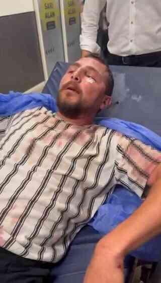 'Gürültü yapmayın' uyarısında anne ve oğula feci dayak! Burnunu ve kemiğini kırdılar