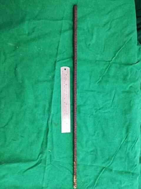 Yaşlı kadın, tarlada çalıştığı sırada 60 cm uzunluğundaki paslı metal çubuğa saplandı