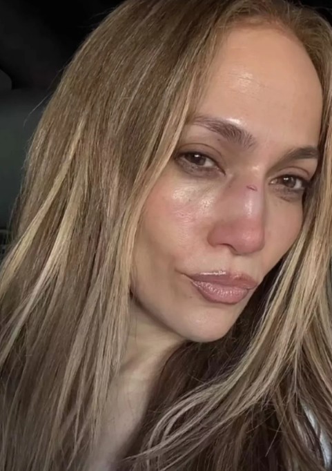 Jennifer Lopez talihsiz bir kaza geçirdi!