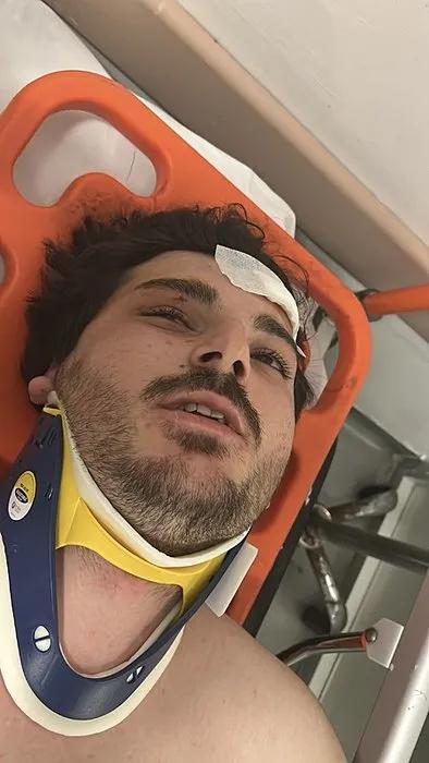 4 kişi tarafından darp edilen ünlü oyuncu: Kamyoncu araya girmeseydi ölecektim 4 kişi tarafından darp edilen ünlü oyuncu: Kamyoncu araya girmeseydi ölecektim