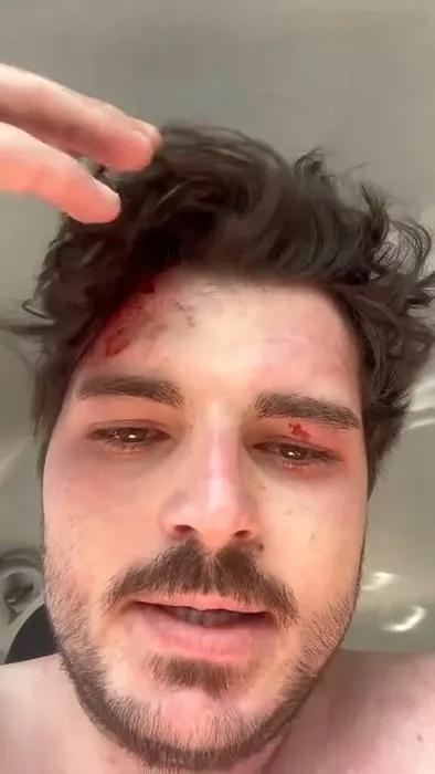 4 kişi tarafından darp edilen ünlü oyuncu: Kamyoncu araya girmeseydi ölecektim 4 kişi tarafından darp edilen ünlü oyuncu: Kamyoncu araya girmeseydi ölecektim