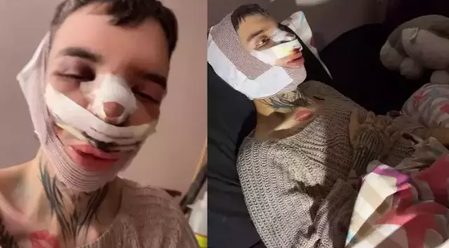 Zorbalığa daha fazla dayanamayan 'Tablet Reis' 5 ayrı yüz ameliyatı oldu