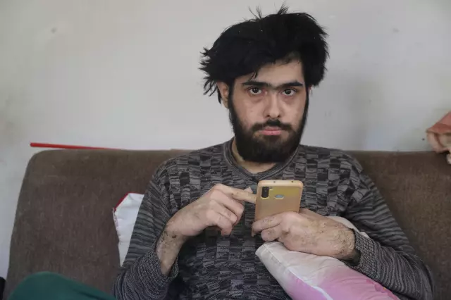 3 yıldır tırnaklarını kesmeyen ve duş almayan gencin eski hali ortaya çıktı 3 yıldır tırnaklarını kesmeyen ve duş almayan gencin eski hali ortaya çıktı