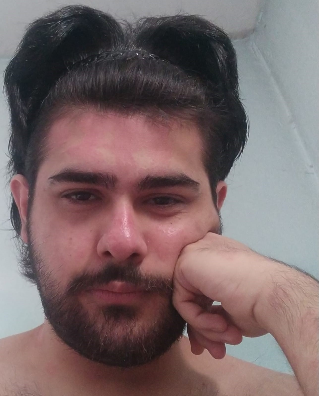 3 yıldır tırnaklarını kesmeyen ve duş almayan gencin eski hali ortaya çıktı 3 yıldır tırnaklarını kesmeyen ve duş almayan gencin eski hali ortaya çıktı