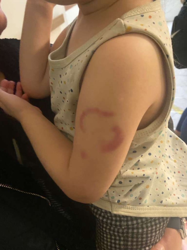 Öğrencisinin kolunu ısırdığı iddia edilen öğretmen tutuklandı Öğrencisinin kolunu ısırdığı iddia edilen öğretmen tutuklandı