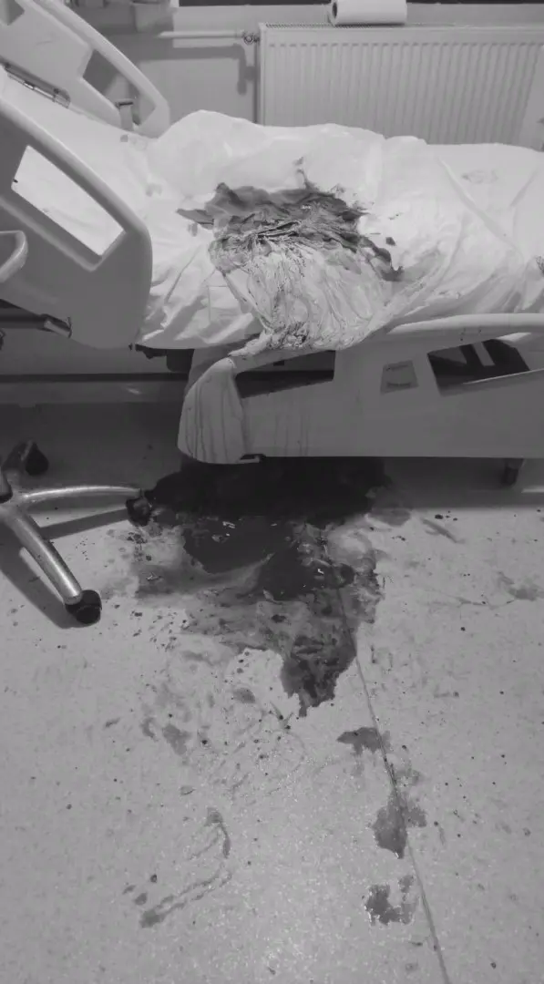'Hastane servis odasındaki doğumda doktorun elinden kayan bebek öldü' iddiasına çifte soruşturma 'Hastane servis odasındaki doğumda doktorun elinden kayan bebek öldü' iddiasına çifte soruşturma