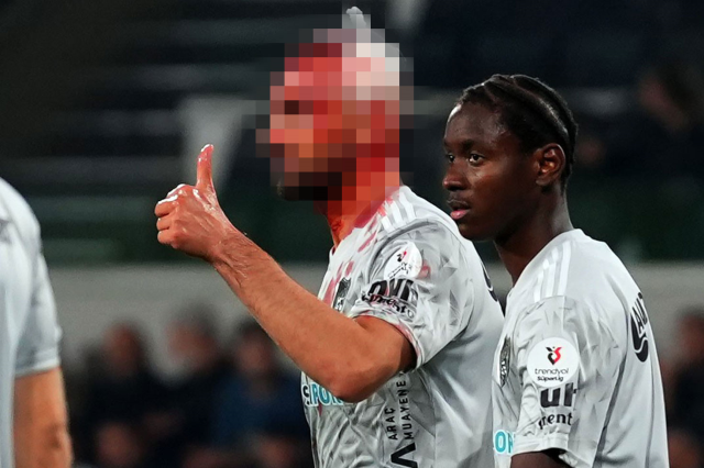 Süper Lig'de korkutan sakatlık! Kafası yarıldı, yürekler ağızlara geldi