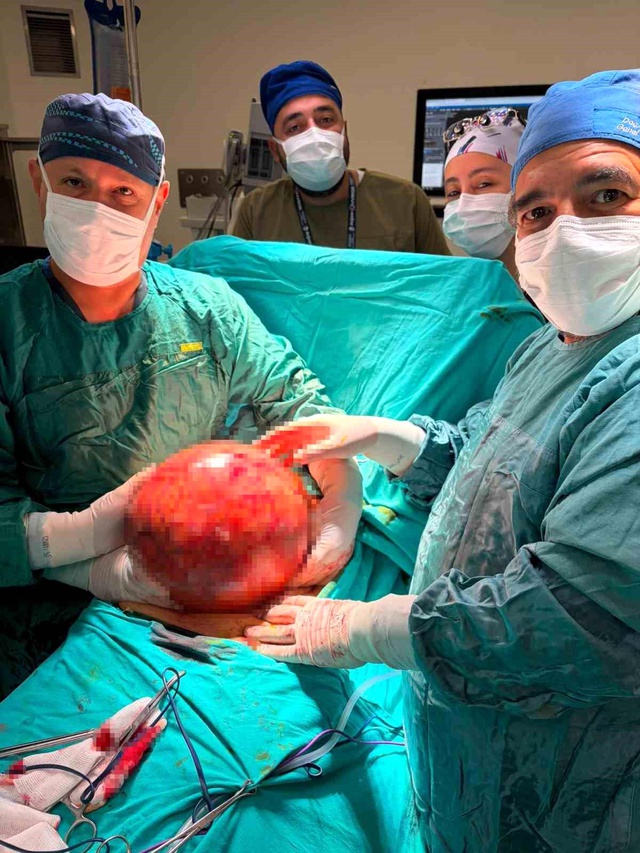 Halsizlik şikayetiyle hastaneye gitti, karnından 6,5 kilogramlık tümör çıktı