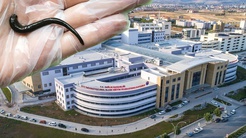 Boğaz ağrısıyla acile giden hastada şaşırtan teşhis: Ses tellerinin arkasında canlı sülük