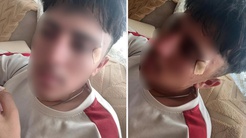 İddia vahim! Öğretmenin kafa attığı çocuğun burnu kırıldı