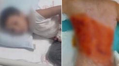 12 yaşındaki çocuğu kolonya döküp yaktılar! Sonrası daha da korkunç