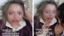 Genç kızı darp edip özür dilettiler, o anları sosyal medyada paylaştılar