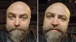 Saçsız adam isyan etti! Berbere ödediği ücret öyle böyle değil